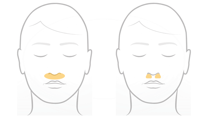 Fisher & Paykel Solo Nasenpolster-CPAP-Maske